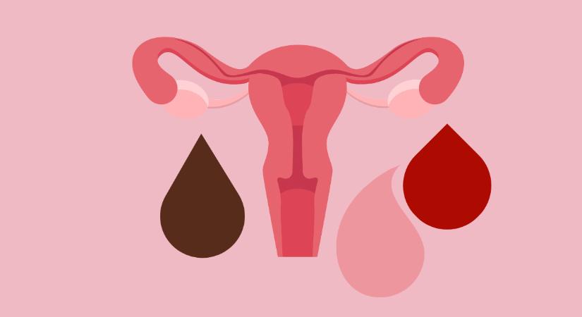 Ezt próbálja jelezni neked a menstruációs vérzésed színe az egészségedről