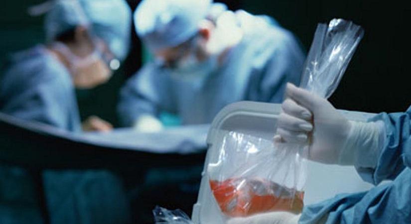 34 szervátültetést végeztek tavaly Debrecenben