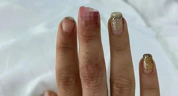 Hátborzongató: Leharapták egy nő ujjbegyét egy thaiföldi strandon