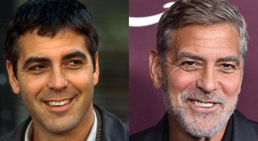 Szinte elkoptatta fogait George Clooney - Sztármosolyok, melyek a fogorvosok munkáját dicsérik
