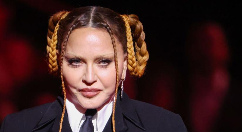 Madonna szerint a fotós lencséje miatt tűnt torznak az arca