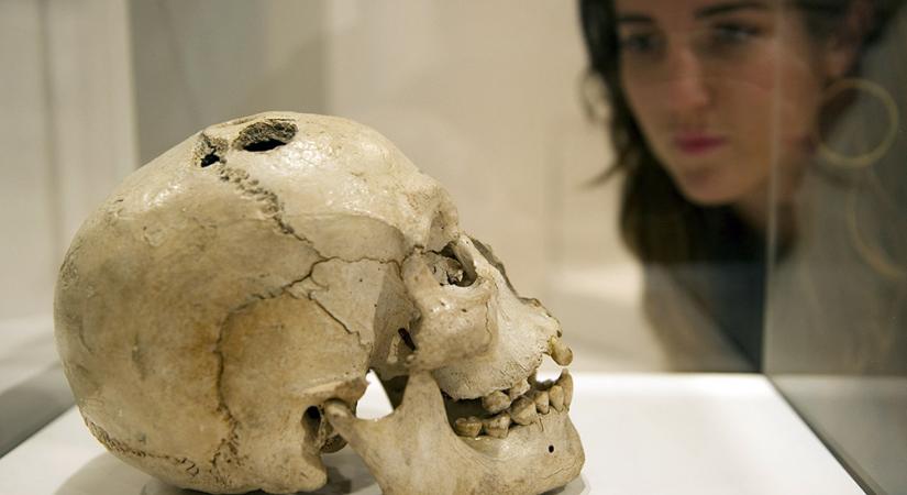 A bronzkori gyerekeknek nem szuvasodott a foguk