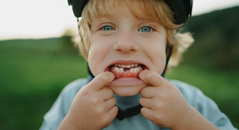 A bronzkorban is jobb volt a gyerekek foga, mint most
