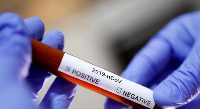 Koronavírus – Csúcson a halálozás, de Heves megyéből jó híreink vannak
