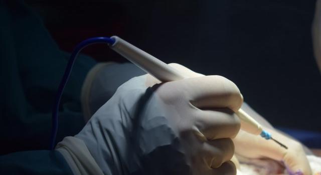 Műtét közben követelt szexet páciensétől a pornófüggő plasztikai sebész