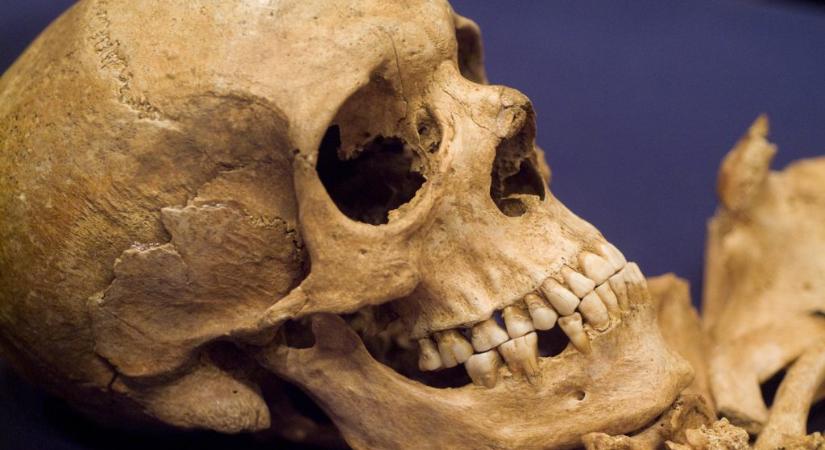 Emberi koponyából készült az ősi ékszer