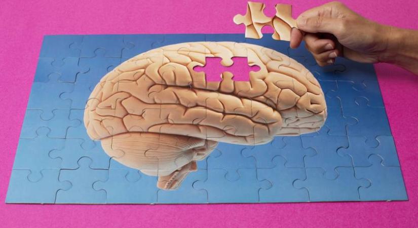 Megdöbbentően fiatalon diagnosztizáltak valakit Alzheimer-kórral: memóriaproblémák jelentkeztek nála
