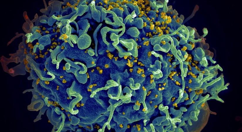 Már a harmadik HIV-beteget nyilvánították gyógyulttá az őssejtterápiának hála