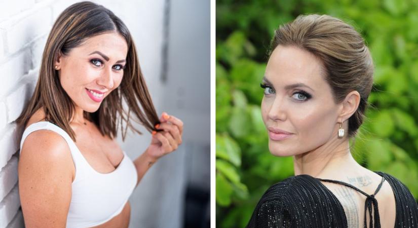 Megyeri Csilla szépészeti beavatkozáson járt, hogy Angelina Jolie-profilt csináljanak neki