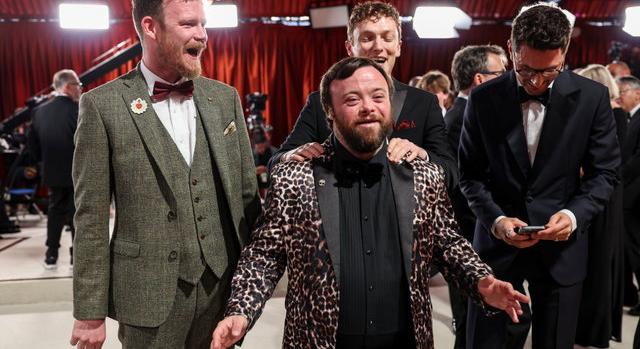 Az Oscar-nyertes film után visszament a kávézóba dolgozni a Down-szindrómás színész