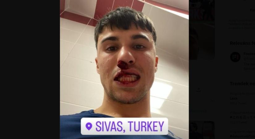 Pályára berohanó török szurkoló törte be az olasz játékos orrát (VIDEÓ)