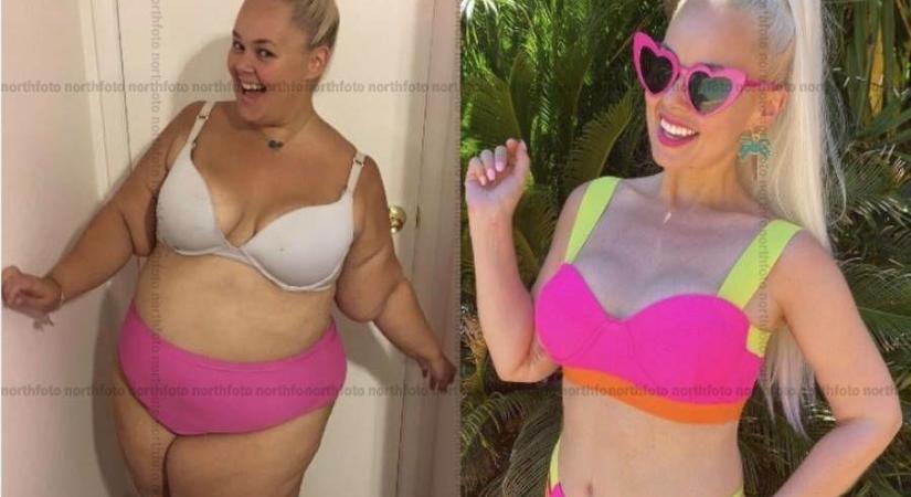 90 kilót dobott le a Barbie-mániás ausztrál nő, ez mentette meg az életét