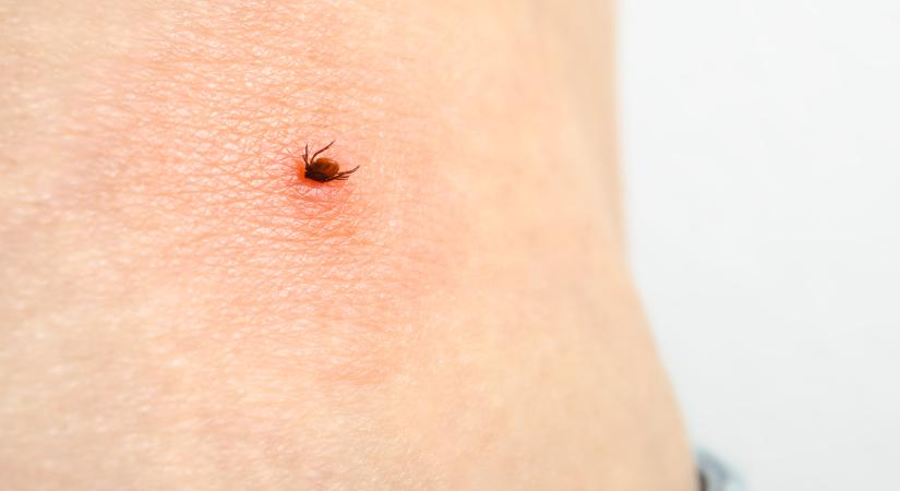 Endometriózis és Lyme-kór: így függhet össze a kettő betegség