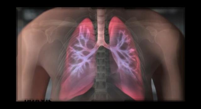 A COPD gyógyíthatatlan tüdőbetegség, de a tünetek enyhíthetők – Praxis 2023-03-22