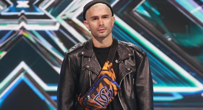 ByeAlex új, több százezres Gucci cipőjével villogott: ennyibe fájhatott az énekesnek - fotó