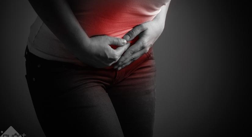 Őszintén az endometriózisról