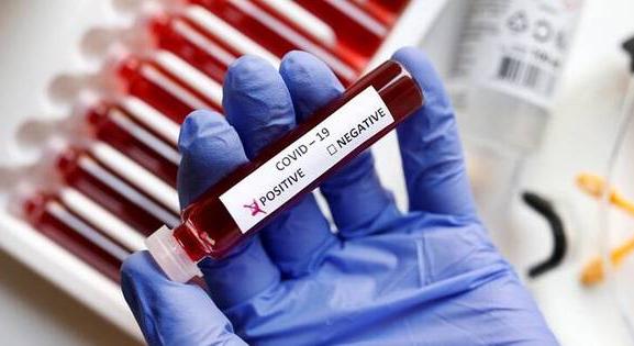 Koronavírus: az előző héten 685 új fertőzöttet igazoltak, elhunyt 12 beteg