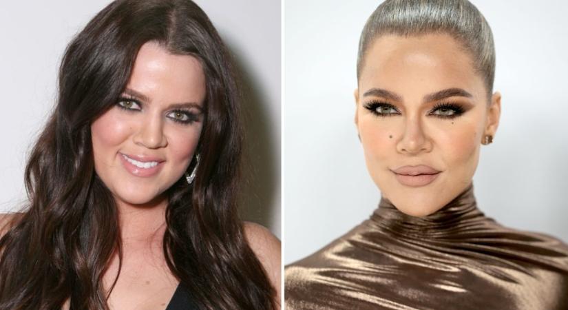 Khloé Kardashian egy szóval elintézte a kommentelőt, aki megkérdezte, hiányzik-e neki a régi arca
