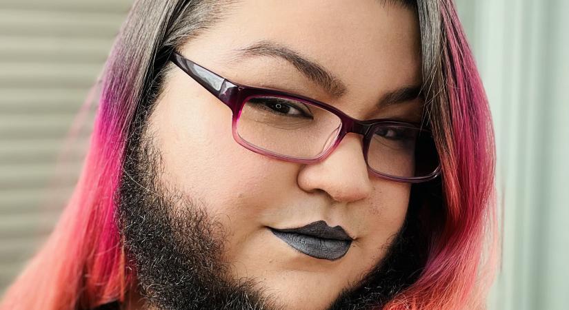 Hosszú idő után büszke szakállára a 29 éves nő