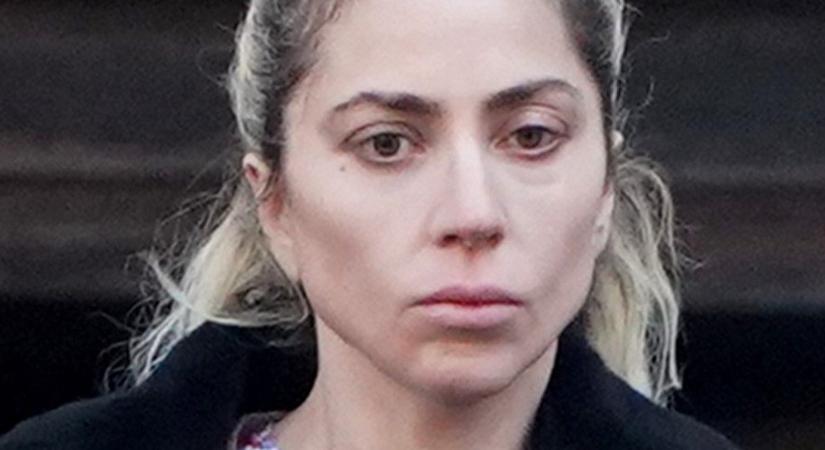 Aggasztó lesifotók kerültek ki Lady Gaga-ról, valami nincs rendben a popsztárral?