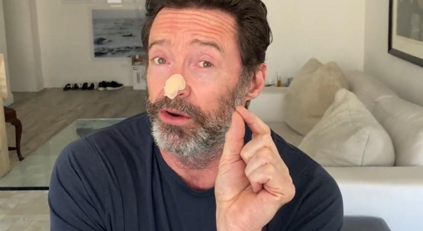 Hugh Jackmannak negatív lett a biopsziája, nincs bőrrákja