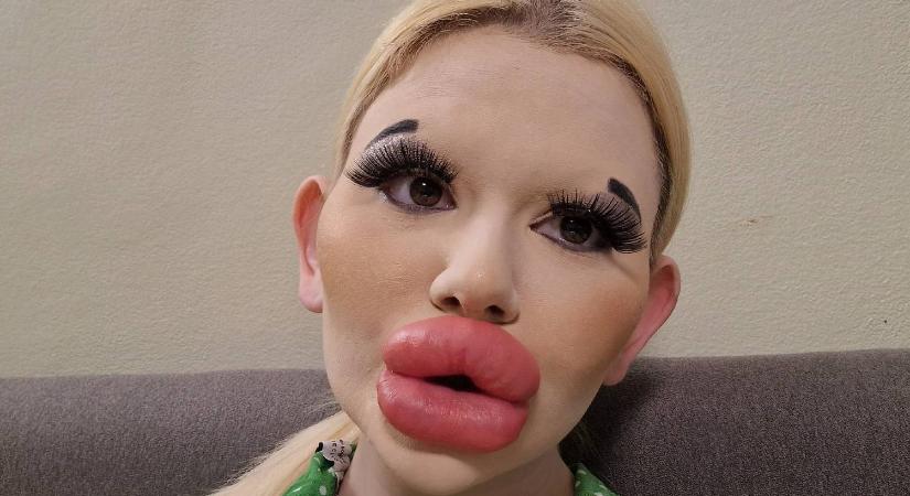 Keresi a szerelmet a világ legnagyobb szájú nője