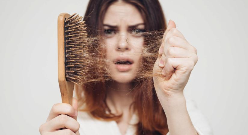 A hajhullást nem csak betegségek okozhatják - Íme a hét leggyakoribb ok