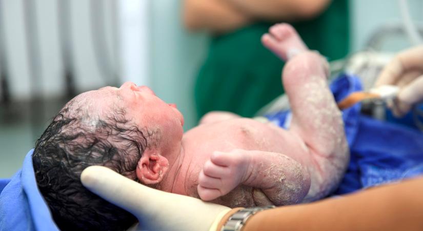 “A császármetszés a legnagyobb hasi műtétek közé tartozik” – a hasi szülés körüli tények és tévhitek