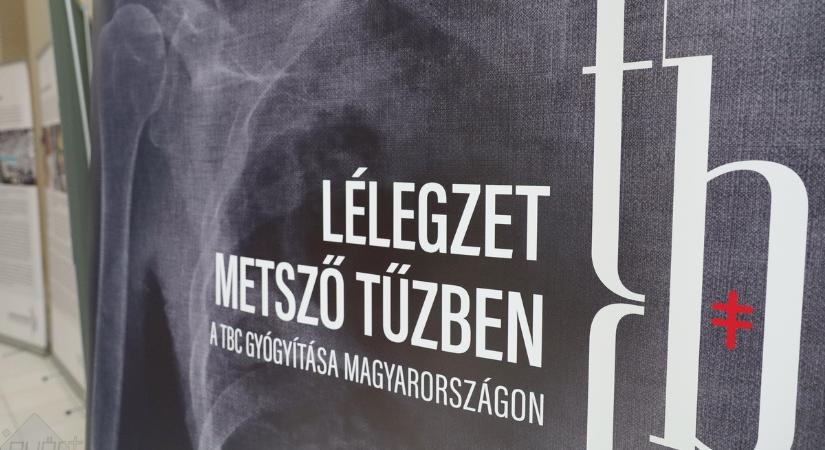 A tbc gyógyításáról nyílt kiállítás a győri kórházban