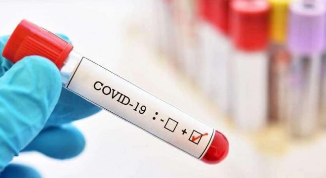 Koronavírus – Csúcson a fertőzöttség, közel 4 ezer új esetet jelentettek be szombaton