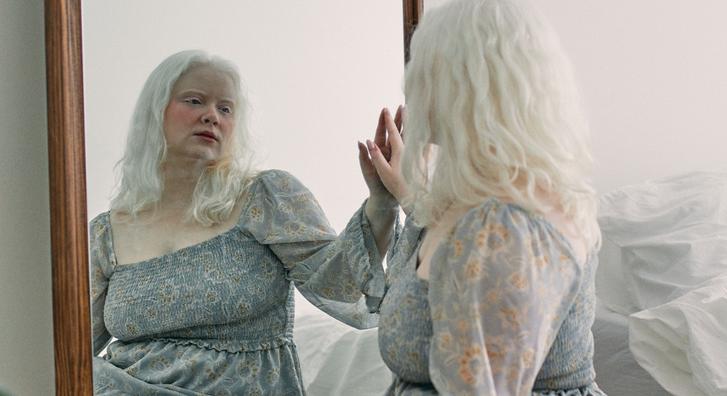 Levetkőzte zárkózottságát az albínó nő, akit gyerekkorában szellemnek gúnyoltak