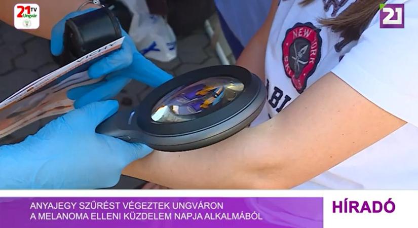 Anyajegy szűrést végeztek Ungváron a melanoma elleni küzdelem napja alkalmából (videó)