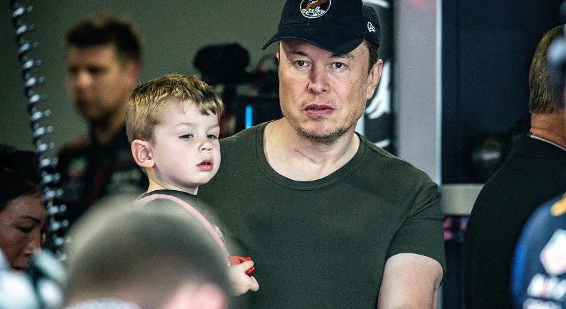 Elon Musk elkezdheti az agyimplantátumok tesztelését embereken