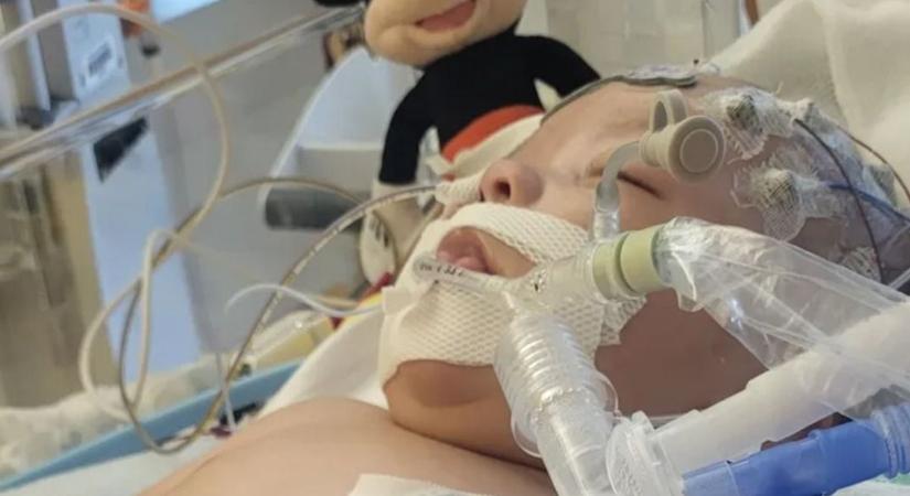 Édesanyja egyetlen tévedése okozott végzetes agykárosodást a csecsemőnek