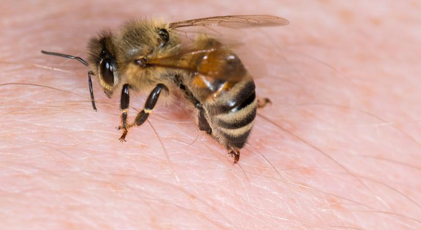 Allergiás a méh-és darázscsípésre? Ezt tegye, ha megcsípte