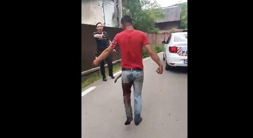 Kolozs megye: lábon lőttek a rendőrök egy fiatalt Bánffyhunyadon