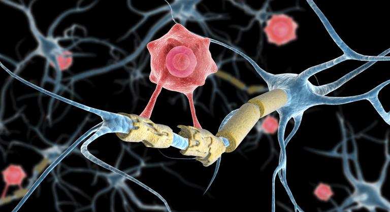 Vadonatúj felfedezésre bukkantak a szklerózis multiplexszel kapcsolatban