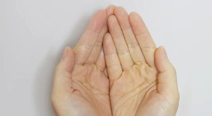 Ha piros vagy lila foltokat észlelsz a tenyereden, azonnal fordulj orvoshoz: akár halálos is lehet