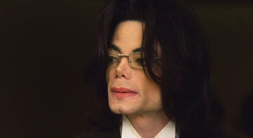 A boncolási jegyzőkönyv szerint horrorsérülések borították Michael Jackson testét, fél szemére pedig vak volt