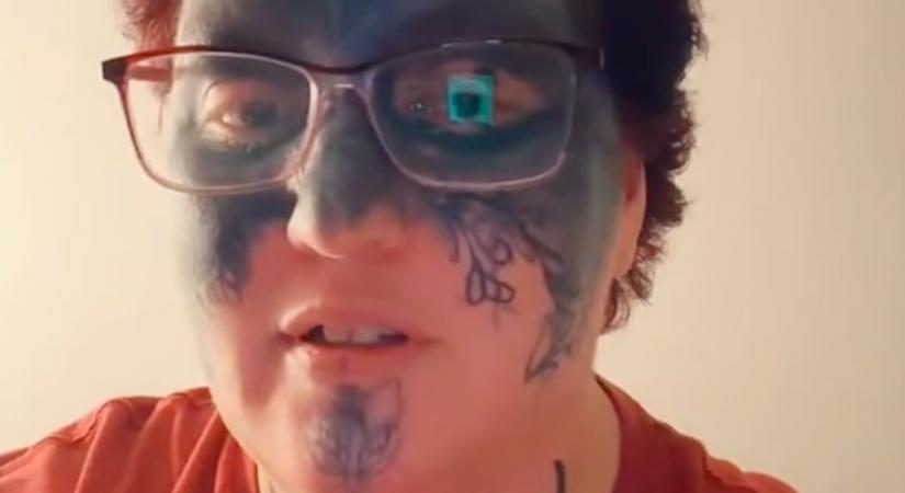Mérhetetlen arcfájdalomra ébredt a nő a hotelszobában: az egész életére hatással lett, ami történt - Videó
