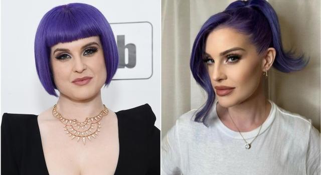 Előtte-utána kép Kelly Osbourne-ról, aki tagadja, hogy kés alá feküdt volna – ön szerint?