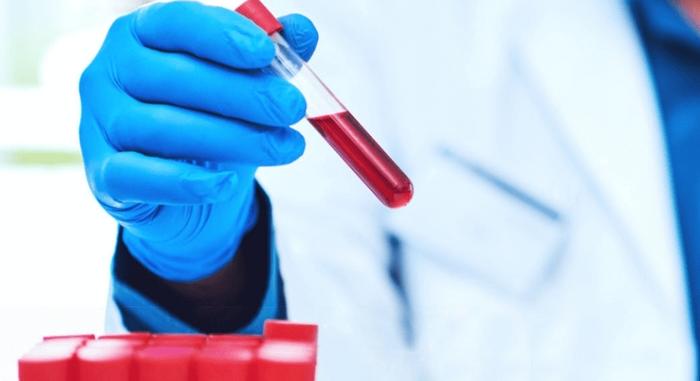 Kiváltható a kolonoszkópia, soványsággal az Alzheimer-kór ellen