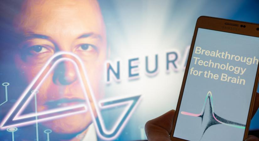 Önkénteseken tesztelheti az agyimplátumát a Neuralink