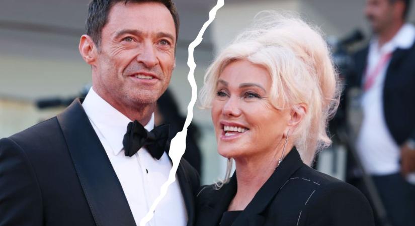 Kiderült vajon, miért válik Hugh Jackman?