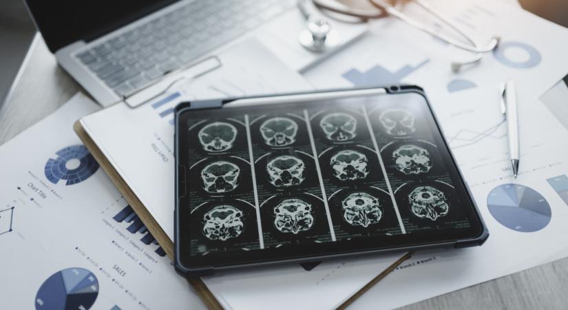 Felcsillant a remény az Alzheimer-kórban szenvedőknek
