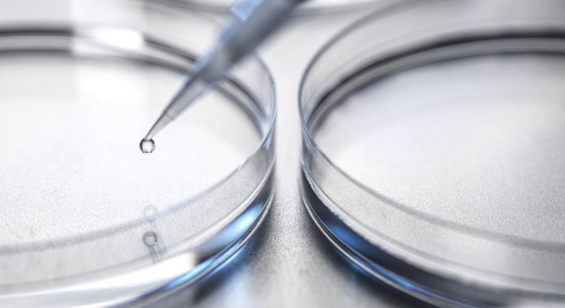 Őssejtterápia segíthet a sclerosis multiplexben szenvedő betegeken