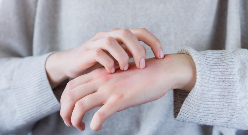 Figyeljünk oda a tenyerünkre - gyilkos betegségek tünetei jelentkezhetnek a kezünkön
