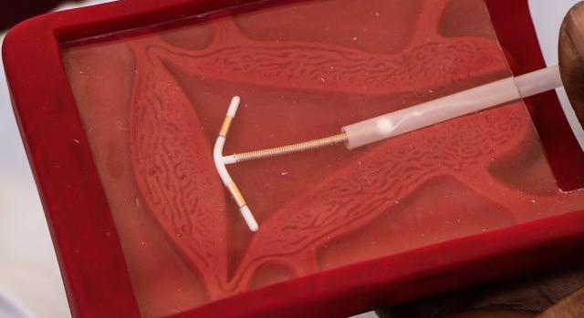 Több tucat grönlandi nő perli az államot, mert a tudtukon kívül helyeztek fel nekik spirált