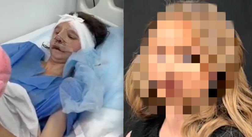 "Nem tudok megbocsátani" - Dianát éveken át kínozta az anyja, most új arcot kapott - Videó