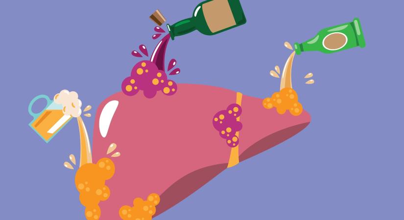 Mennyi alkohol károsítja a májat? Jóval kevesebb, mint gondolná!